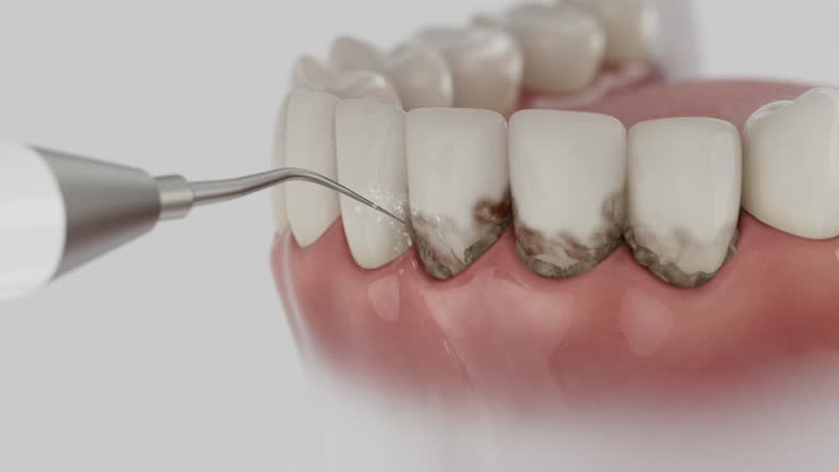 Trusted Teeth Cleaning And Checkup service in Bellflower, CA - Dentist Open Now